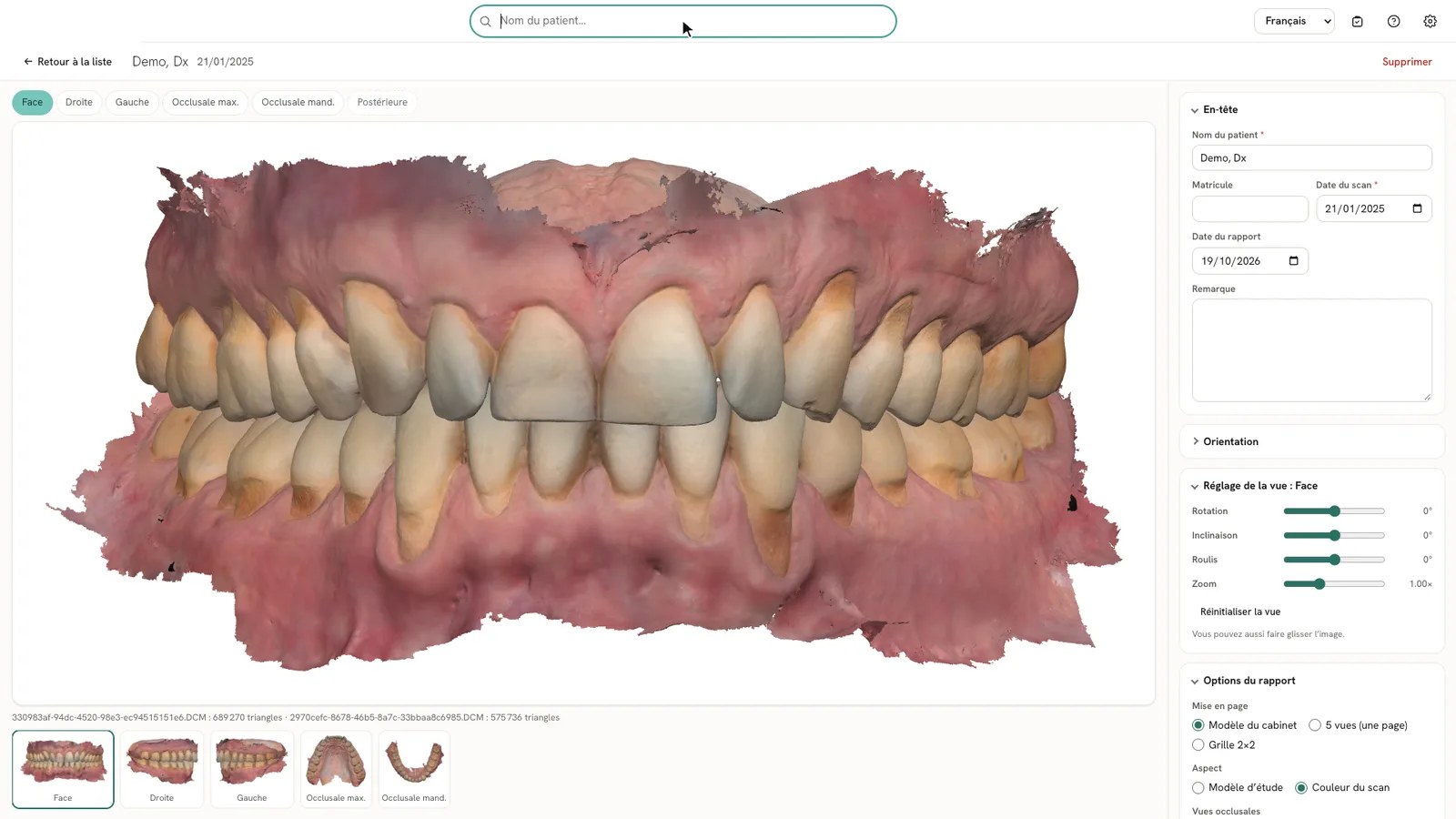 Écran de réglage d'Umbo : vue frontale du modèle 3D et curseurs de rotation, inclinaison et zoom.